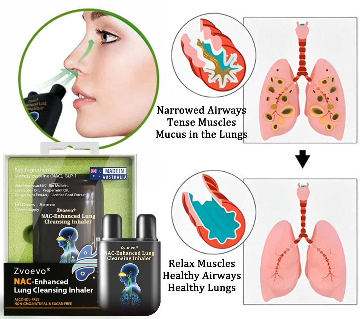 ✅Official Store:Zvoevo® NAC-Enhanced Lung Cleansing Inhaler👨⚕️(🫁Sinusitis,cough, wheezing, shortness of breath, sputum, stuffy nose, bronchitis, allergy symptoms, lung discomfort🫁)