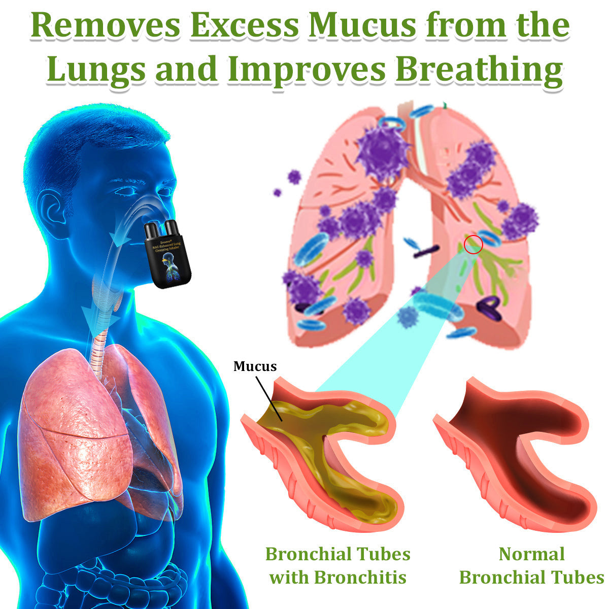 ✅Official Store:Zvoevo® NAC-Enhanced Lung Cleansing Inhaler👨‍⚕️(🫁Sinusitis,cough, wheezing, shortness of breath, sputum, stuffy nose, bronchitis, allergy symptoms, lung discomfort🫁)