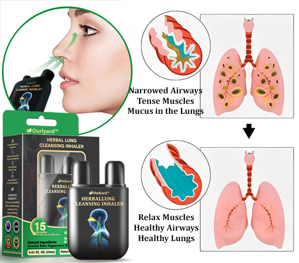 ✅Official Store|Ourlyard™ Herbal Lung Cleansing Inhaler🦘 (💝 Cough, wheezing, shortness of breath, sputum, stuffy nose, bronchitis, bronchitis, allergy symptoms, lung discomfort💝)