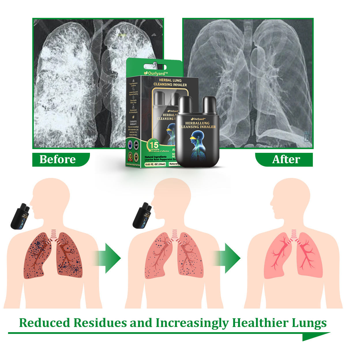 ✅Official Store|Ourlyard™ Herbal Lung Cleansing Inhaler🦘 (💝 Cough, wheezing, shortness of breath, sputum, stuffy nose, bronchitis, bronchitis, allergy symptoms, lung discomfort💝)
