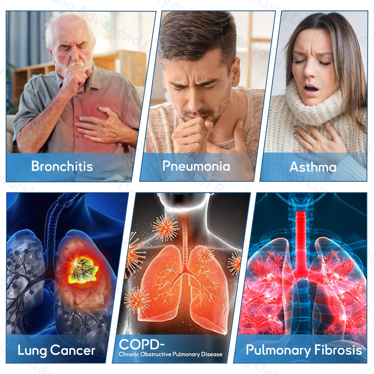 ✅𝐔𝐩𝐠𝐫𝐚𝐝𝐞𝐝 𝐯𝐞𝐫𝐬𝐢𝐨𝐧:𝐎𝐮𝐫𝐥𝐲𝐚𝐫𝐝®  𝐃𝐨𝐮𝐛𝐥𝐞𝐍𝐚𝐧𝐨 𝐀𝐝𝐯𝐚𝐧𝐜𝐞𝐝 𝐋𝐮𝐧𝐠 𝐃𝐞𝐭𝐨𝐱 𝐑𝐞𝐥𝐢𝐞𝐟 𝐏𝐚𝐭𝐜𝐡(💝 Cough, wheezing, shortness of breath, sputum, stuffy nose, bronchitis, bronchitis, allergy symptoms, lung discomfort💝🫁)