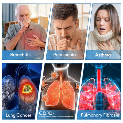 ✅𝐔𝐩𝐠𝐫𝐚𝐝𝐞𝐝 𝐯𝐞𝐫𝐬𝐢𝐨𝐧:𝐎𝐮𝐫𝐥𝐲𝐚𝐫𝐝®  𝐃𝐨𝐮𝐛𝐥𝐞𝐍𝐚𝐧𝐨 𝐀𝐝𝐯𝐚𝐧𝐜𝐞𝐝 𝐋𝐮𝐧𝐠 𝐃𝐞𝐭𝐨𝐱 𝐑𝐞𝐥𝐢𝐞𝐟 𝐏𝐚𝐭𝐜𝐡(💝 Cough, wheezing, shortness of breath, sputum, stuffy nose, bronchitis, bronchitis, allergy symptoms, lung discomfort💝🫁)