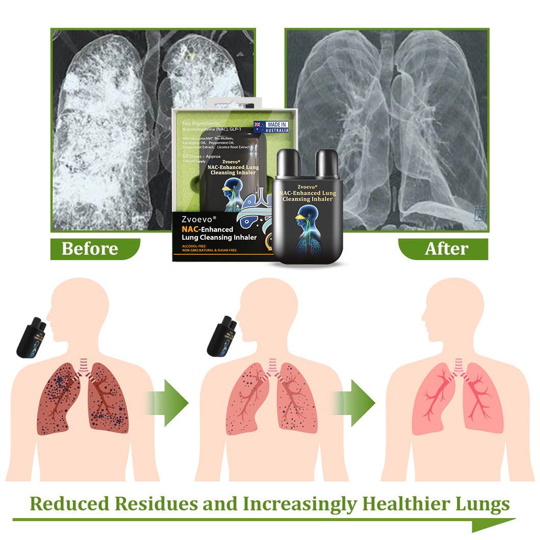 ✅Official Store:Zvoevo® NAC-Enhanced Lung Cleansing Inhaler👨‍⚕️(🫁Sinusitis,cough, wheezing, shortness of breath, sputum, stuffy nose, bronchitis, allergy symptoms, lung discomfort🫁)