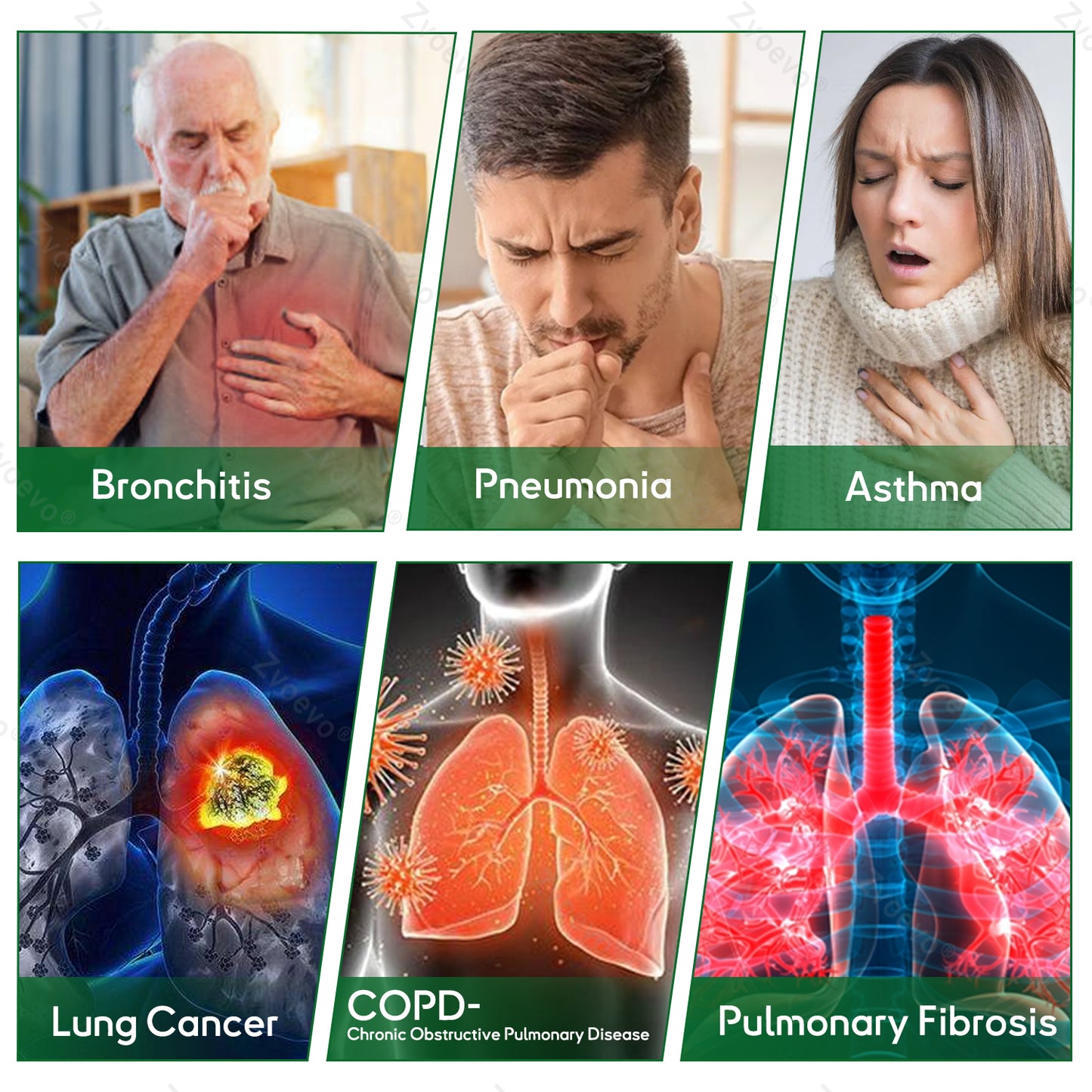 ✅𝐀𝐔 𝐎𝐰𝐧𝐞𝐝 𝐚𝐧𝐝 𝐎𝐩𝐞𝐫𝐚𝐭𝐞𝐝:𝐙𝐯𝐨𝐞𝐯𝐨® 𝐃𝐨𝐮𝐛𝐥𝐞𝐍𝐚𝐧𝐨 𝐀𝐝𝐯𝐚𝐧𝐜𝐞𝐝 𝐋𝐮𝐧𝐠 𝐃𝐞𝐭𝐨𝐱 𝐑𝐞𝐥𝐢𝐞𝐟 𝐏𝐚𝐭𝐜𝐡(💝 Cough, wheezing, shortness of breath, sputum, stuffy nose, bronchitis, bronchitis, allergy symptoms, lung discomfort💝)