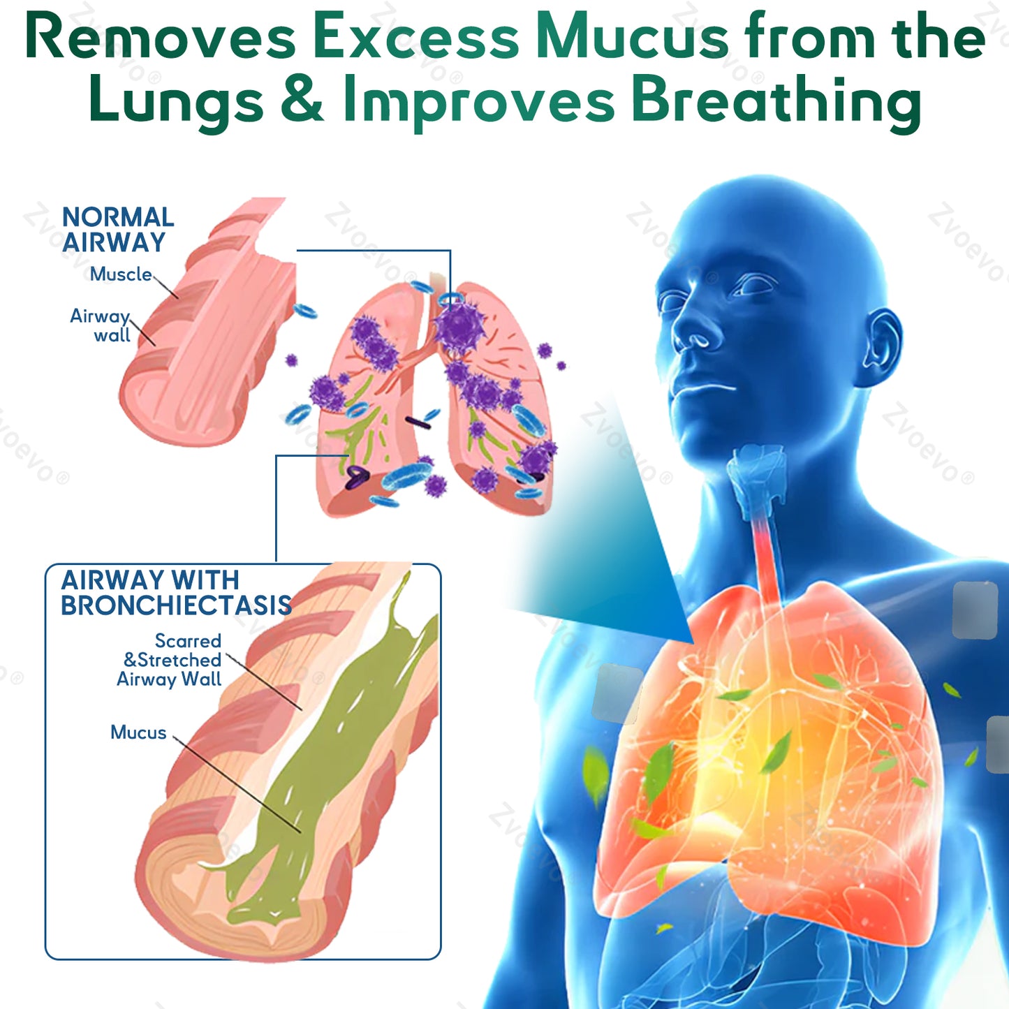 ✅𝐀𝐔 𝐎𝐰𝐧𝐞𝐝 𝐚𝐧𝐝 𝐎𝐩𝐞𝐫𝐚𝐭𝐞𝐝:𝐙𝐯𝐨𝐞𝐯𝐨® 𝐃𝐨𝐮𝐛𝐥𝐞𝐍𝐚𝐧𝐨 𝐀𝐝𝐯𝐚𝐧𝐜𝐞𝐝 𝐋𝐮𝐧𝐠 𝐃𝐞𝐭𝐨𝐱 𝐑𝐞𝐥𝐢𝐞𝐟 𝐏𝐚𝐭𝐜𝐡(💝 Cough, wheezing, shortness of breath, sputum, stuffy nose, bronchitis, bronchitis, allergy symptoms, lung discomfort💝)